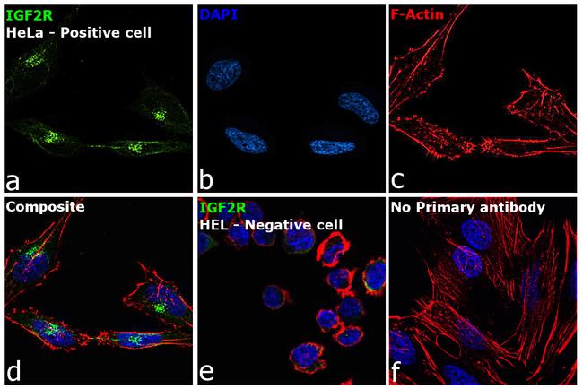 IGF2R Antibody in Immunocytochemistry (ICC/IF)