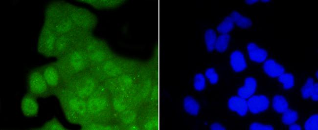 CDK2 Antibody in Immunocytochemistry (ICC/IF)