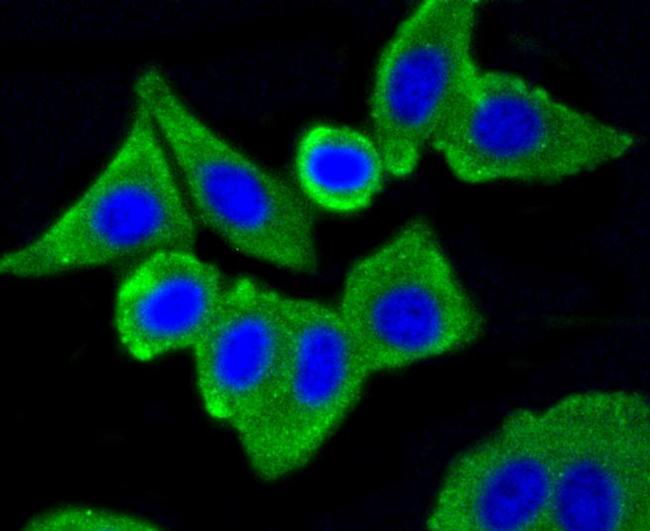 Caveolin 1 Antibody in Immunocytochemistry (ICC/IF)