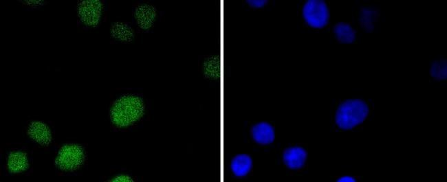 MSH6 Antibody in Immunocytochemistry (ICC/IF)