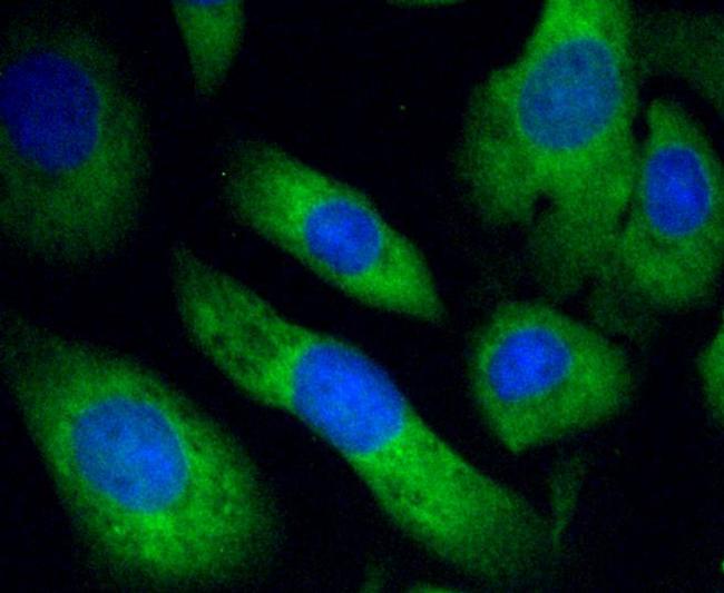 PHD1 Antibody in Immunocytochemistry (ICC/IF)