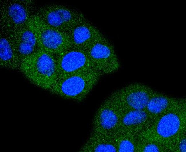 TACC3 Antibody in Immunocytochemistry (ICC/IF)