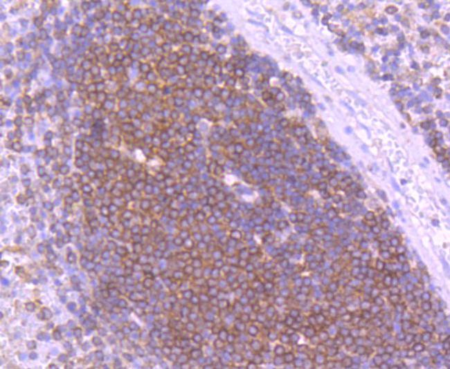 SHIP1 Antibody in Immunohistochemistry (Paraffin) (IHC (P))