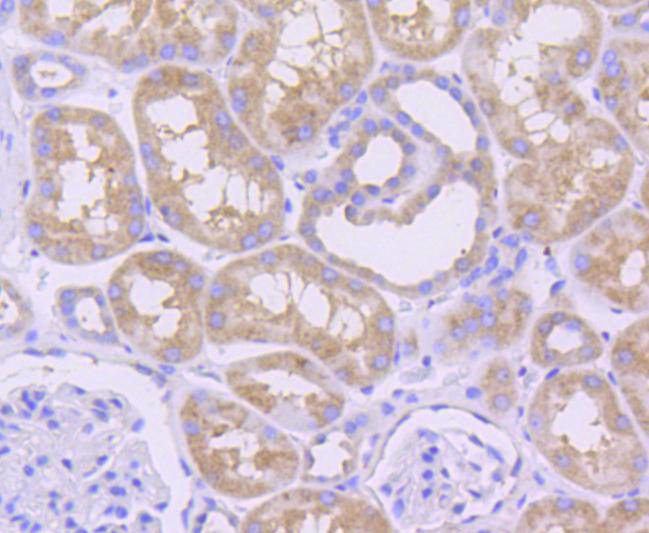 MCL-1 Antibody in Immunohistochemistry (Paraffin) (IHC (P))