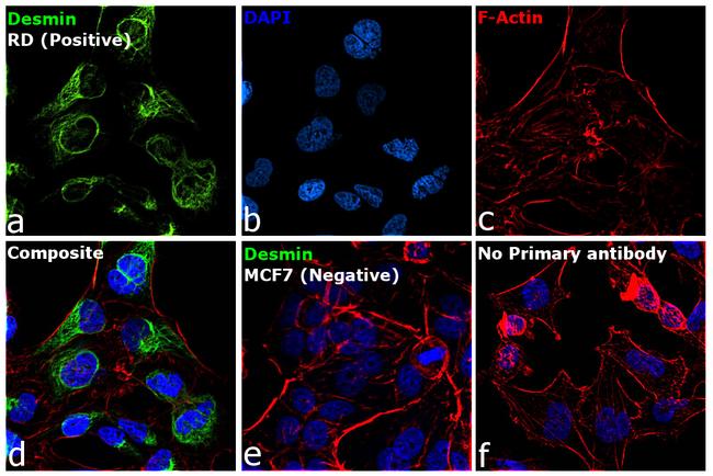 Desmin Antibody in Immunocytochemistry (ICC/IF)