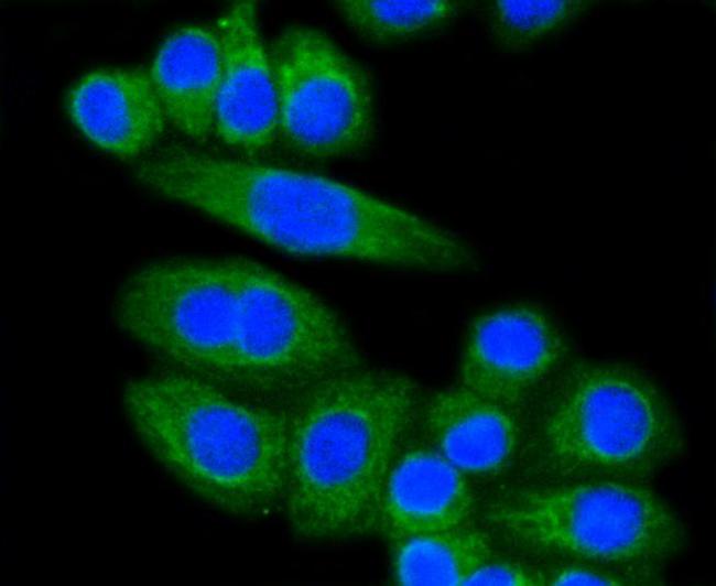 LDLR Antibody in Immunocytochemistry (ICC/IF)