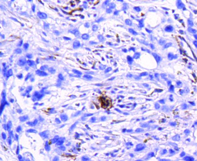 CD61 (Integrin beta 3) Antibody in Immunohistochemistry (Paraffin) (IHC (P))