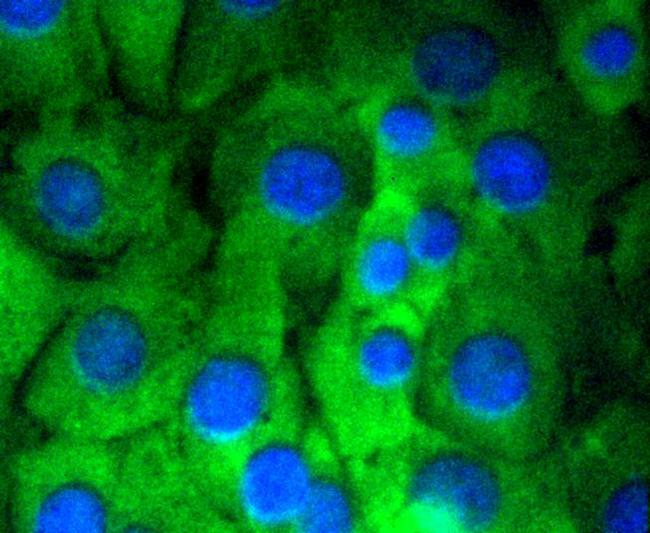 NOTCH1 Antibody in Immunocytochemistry (ICC/IF)