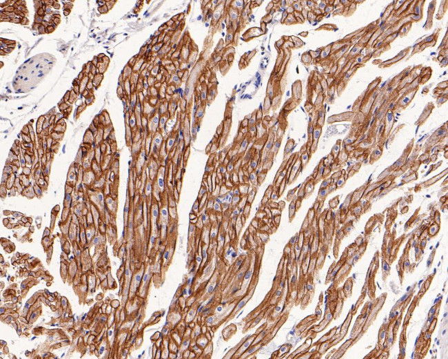 Caveolin 3 Antibody in Immunohistochemistry (Paraffin) (IHC (P))