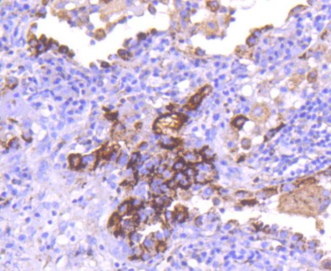 CD63 Antibody in Immunohistochemistry (Paraffin) (IHC (P))