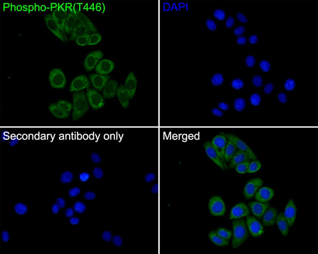 Phospho-PKR (Thr446) Antibody in Immunocytochemistry (ICC/IF)