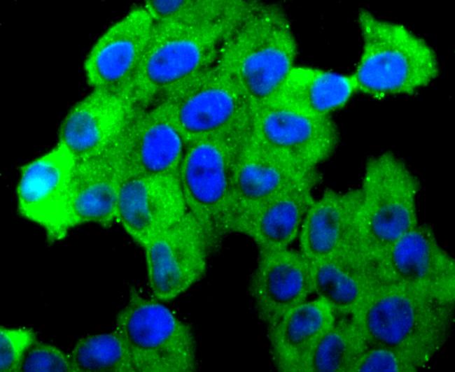 N-cadherin Antibody in Immunocytochemistry (ICC/IF)