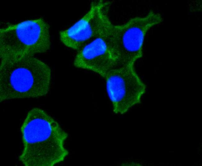 NOX4 Antibody in Immunocytochemistry (ICC/IF)