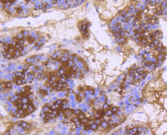 DNAJC15 Antibody in Immunohistochemistry (Paraffin) (IHC (P))