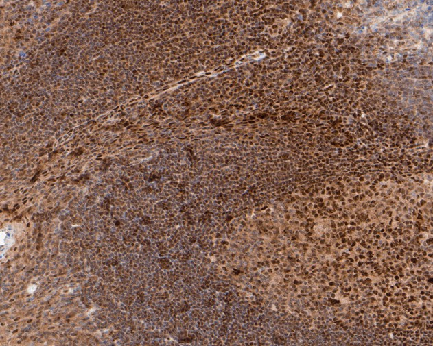 Phospho-HSF1 (Ser326) Antibody in Immunohistochemistry (Paraffin) (IHC (P))