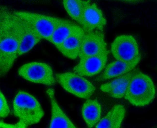 PKC alpha Antibody in Immunocytochemistry (ICC/IF)