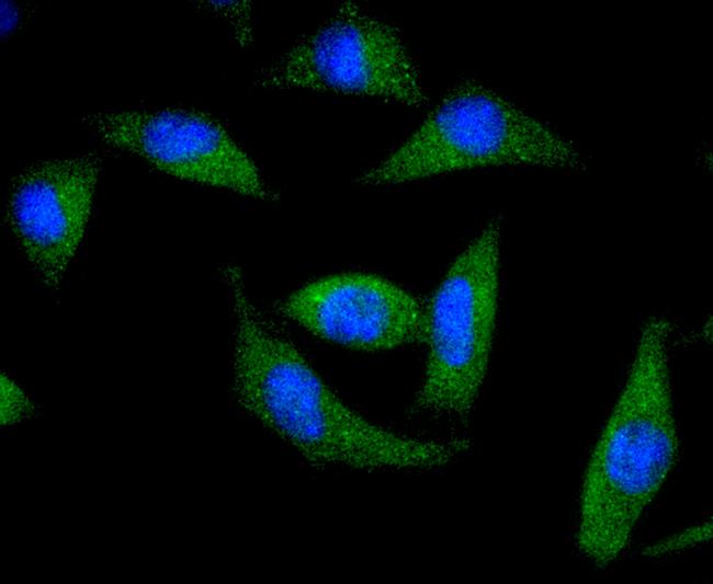 DARPP-32 Antibody in Immunocytochemistry (ICC/IF)