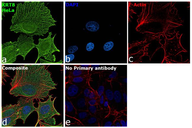 Cytokeratin 8 Antibody in Immunocytochemistry (ICC/IF)