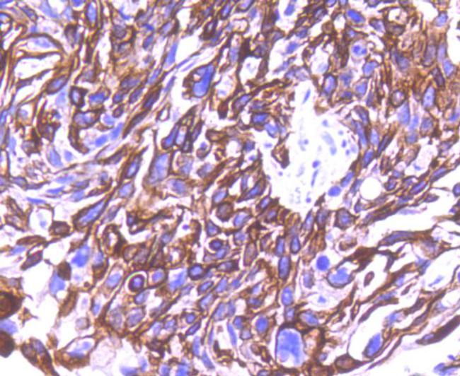 Cytokeratin 8 Antibody in Immunohistochemistry (Paraffin) (IHC (P))