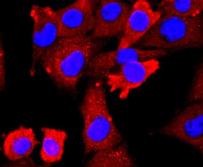 CD309 (FLK1) Antibody in Immunocytochemistry (ICC/IF)