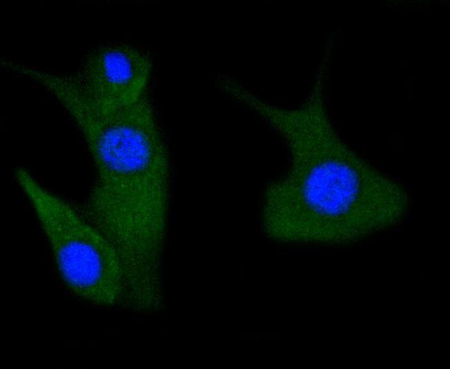 Phospho-PAK1/2/3 (Ser144, Ser141, Ser139) Antibody in Immunocytochemistry (ICC/IF)