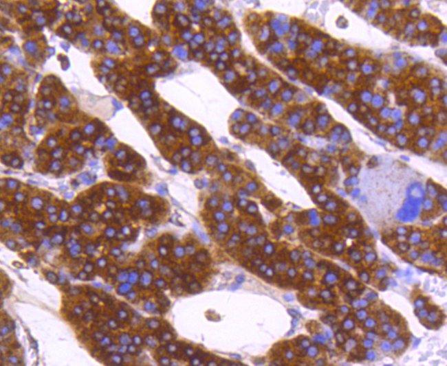 Calreticulin Antibody in Immunohistochemistry (Paraffin) (IHC (P))