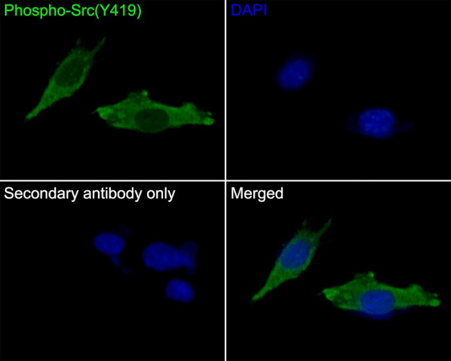 Phospho-SRC (Tyr419) Antibody in Immunocytochemistry (ICC/IF)