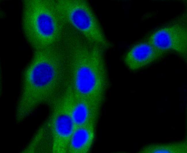 PIK3R2 Antibody in Immunocytochemistry (ICC/IF)