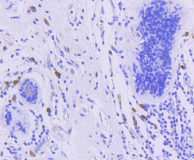 Phospho-FOXO3A (Ser253) Antibody in Immunohistochemistry (Paraffin) (IHC (P))