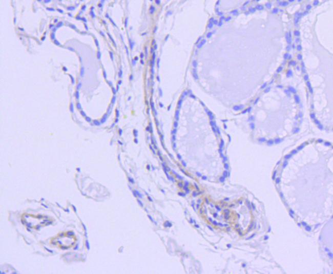 ROCK1 Antibody in Immunohistochemistry (Paraffin) (IHC (P))