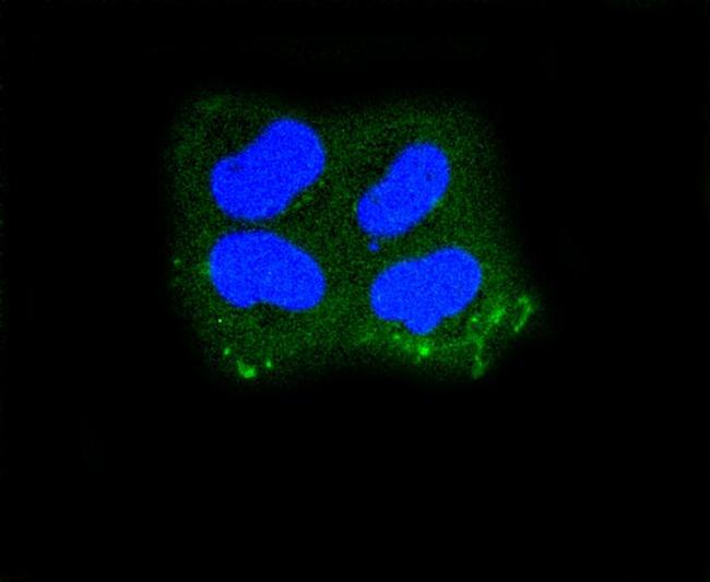 Cytokeratin 10 Antibody in Immunocytochemistry (ICC/IF)