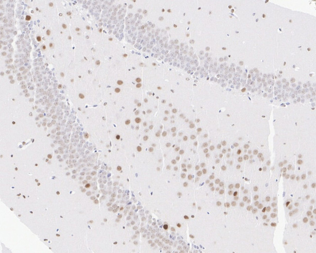 ESRRA Antibody in Immunohistochemistry (Paraffin) (IHC (P))