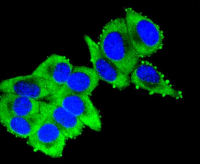 Cytokeratin 16 Antibody in Immunocytochemistry (ICC/IF)