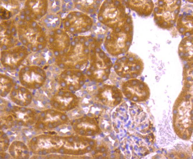 BCL2A1 Antibody in Immunohistochemistry (Paraffin) (IHC (P))