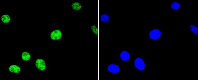 Phospho-ATF2 (Thr71) Antibody in Immunocytochemistry (ICC/IF)