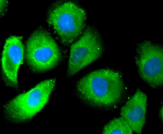 Phospho-Estrogen Receptor alpha (Ser118) Antibody in Immunocytochemistry (ICC/IF)