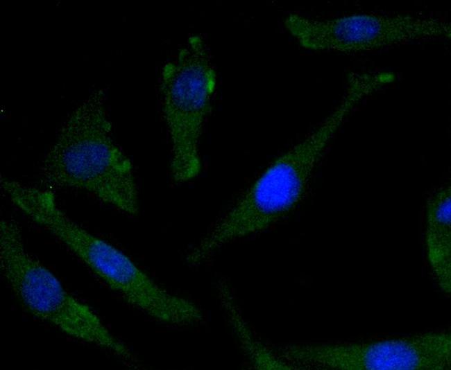 Phospho-TrkB (Tyr817) Antibody in Immunocytochemistry (ICC/IF)