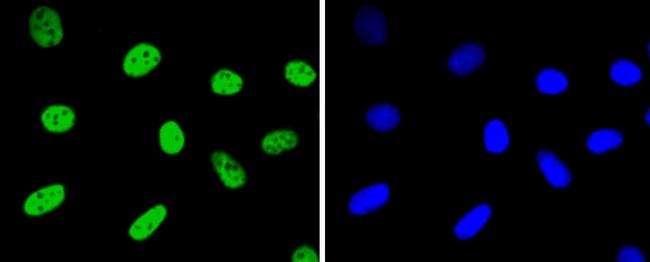 hnRNP K Antibody in Immunocytochemistry (ICC/IF)