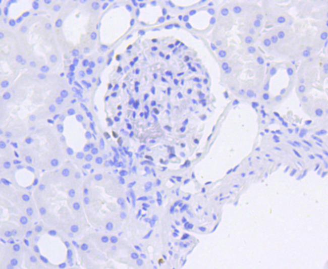 WT1 Antibody in Immunohistochemistry (Paraffin) (IHC (P))