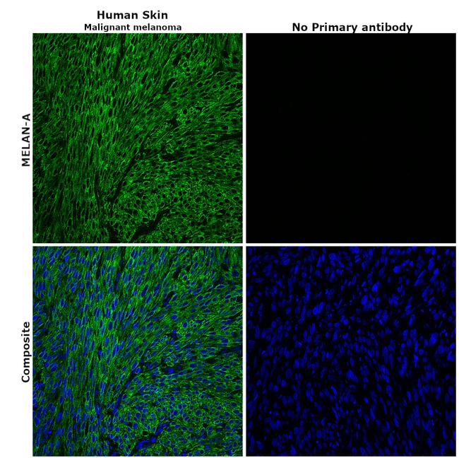 Melan-A Antibody in Immunohistochemistry (Paraffin) (IHC (P))