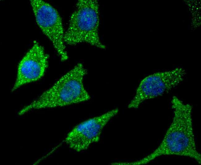 Asparagine Synthetase Antibody in Immunocytochemistry (ICC/IF)