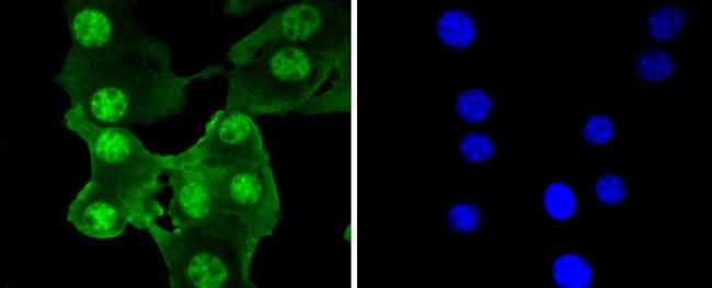 PRP19 Antibody in Immunocytochemistry (ICC/IF)