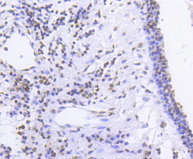 Phospho-SMC1 (Ser957) Antibody in Immunohistochemistry (Paraffin) (IHC (P))