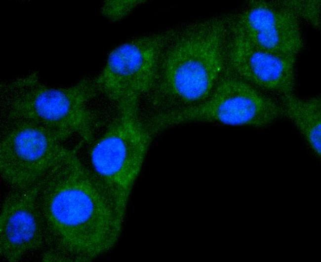 DIABLO Antibody in Immunocytochemistry (ICC/IF)