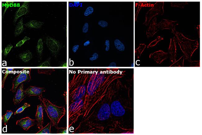 MyD88 Antibody in Immunocytochemistry (ICC/IF)