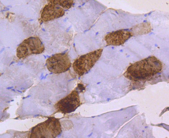 MYL2 Antibody in Immunohistochemistry (Paraffin) (IHC (P))