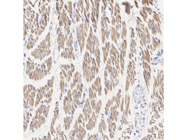 Phospho-HSL (Ser853) Antibody in Immunohistochemistry (Paraffin) (IHC (P))