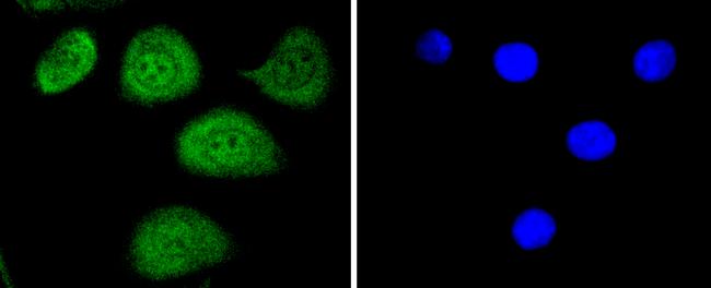 Phospho-c-Myc (Thr58) Antibody in Immunocytochemistry (ICC/IF)