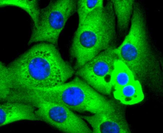 RAD18 Antibody in Immunocytochemistry (ICC/IF)