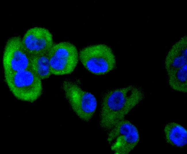 TACC3 Antibody in Immunocytochemistry (ICC/IF)